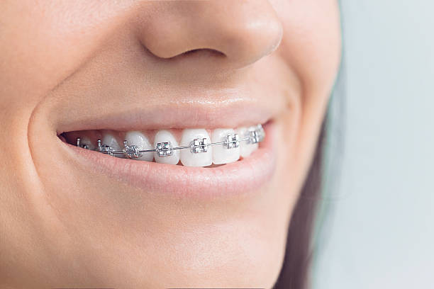  Celoron, NY Dental Services Pros